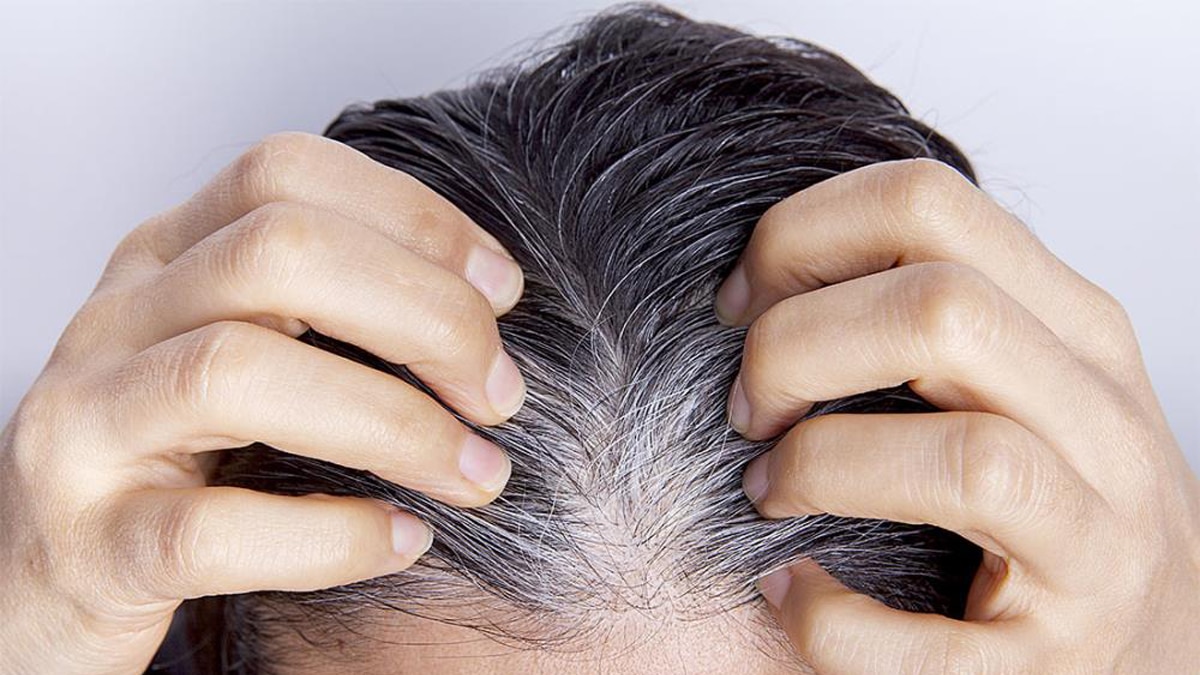 Capelli bianchi